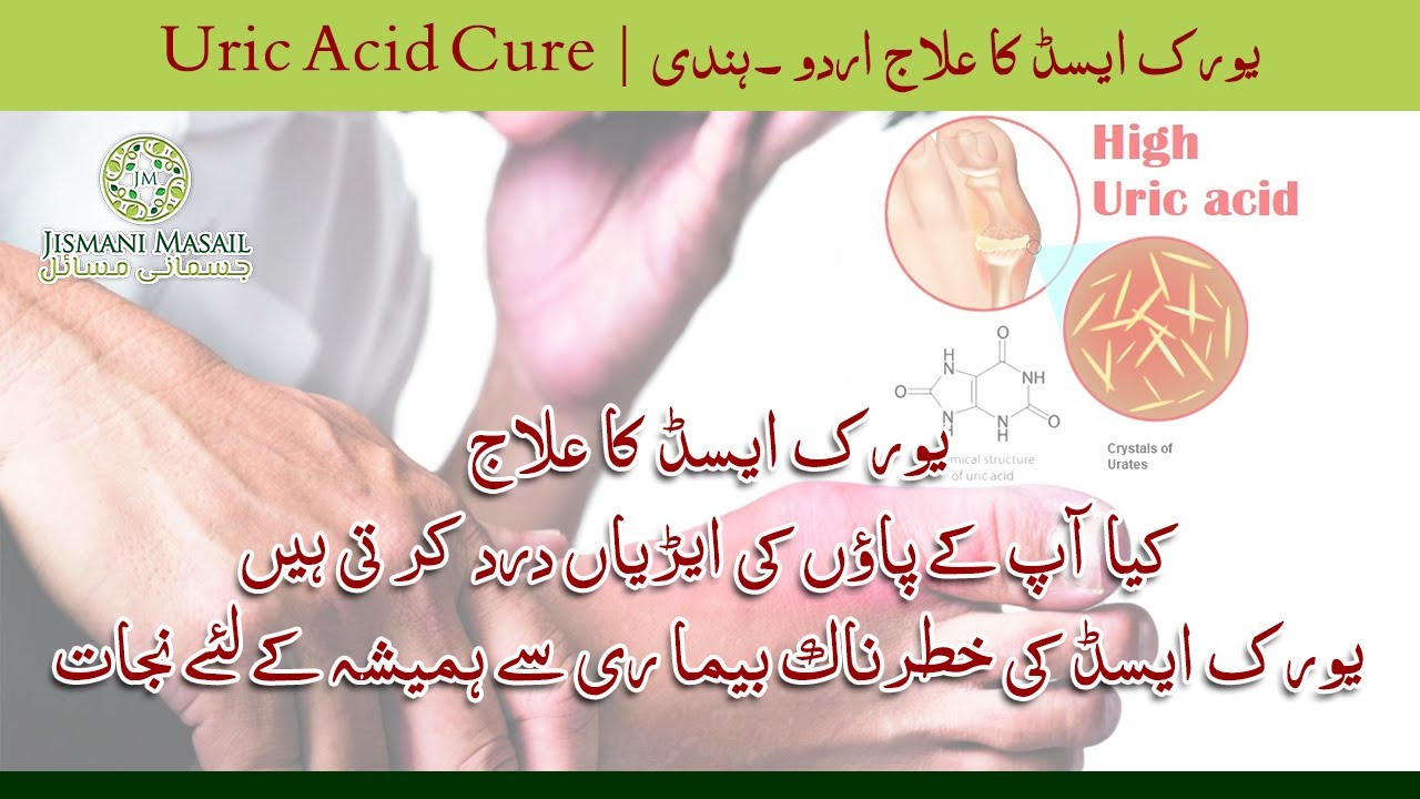 Treatment of Uric Acid  Urdu  Hindi        