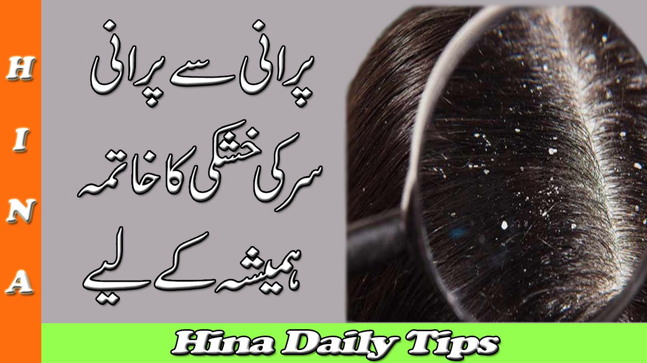 Dandruff Khatam Karne Ka Tarika        Hina Daily 