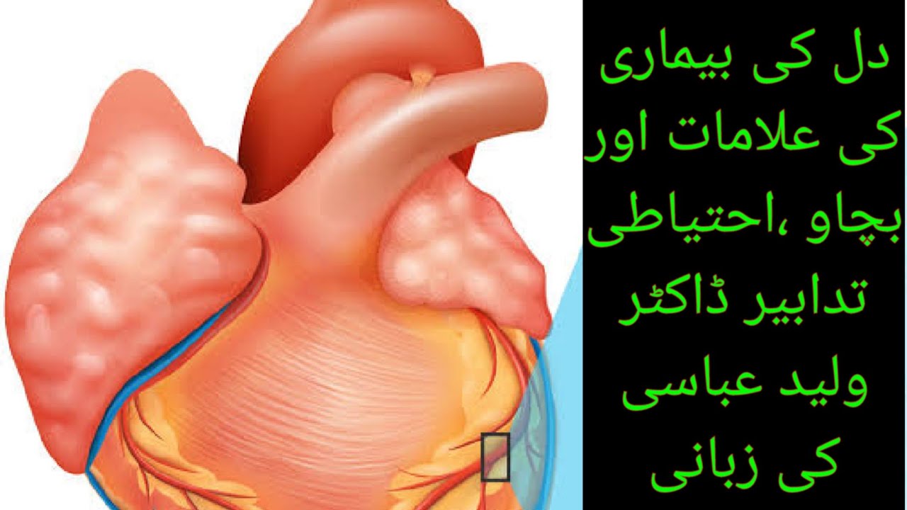 How to Avoid Heart Disease in Urdu