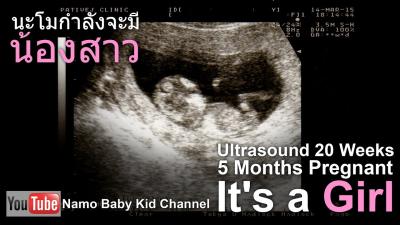 How Many Weeks is 5 Months Pregnant in Urdu