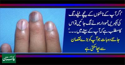How Long Does It Take for Nails to Decompose in Urdu