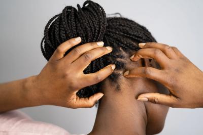 How to Treat Dry Scalp in Urdu
