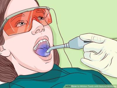 How to Whiten My Teeth in Urdu