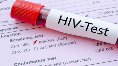 How Soon Can HIV Be Detected by a Blood Test in Urdu