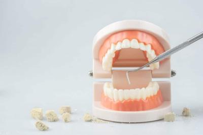 How to Remove Tartar from Teeth in Urdu