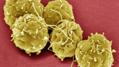 How Does Stem Cell Therapy Work in Urdu