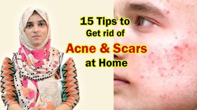 How to Remove Acne from Face in Urdu