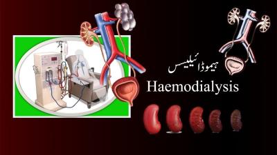 How to Calculate Dry Weight Dialysis in Urdu